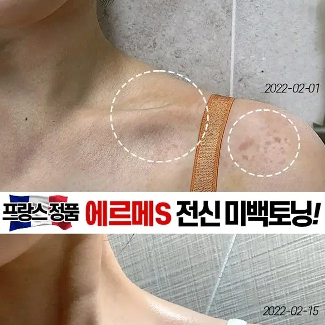 겨드랑이 색소침착 검버섯 닭살 전신미백 화장품 향수바디워시 미백비누메디필