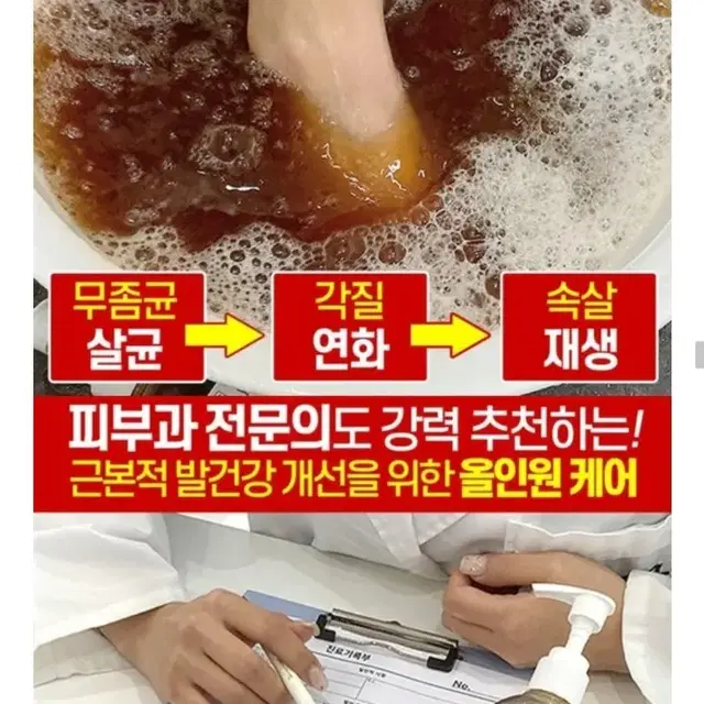 풋케어 무좀 곰팡이균 발각질 세균 간지러움 무좀원인 완벽제거 젤네일