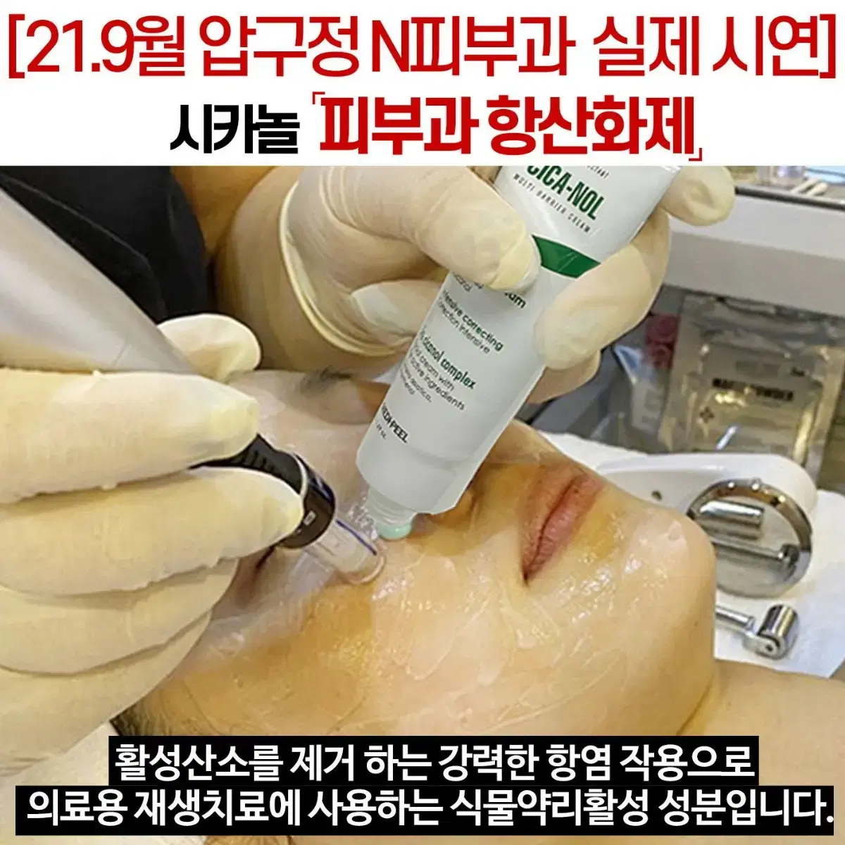 메디필 시카놀 크림