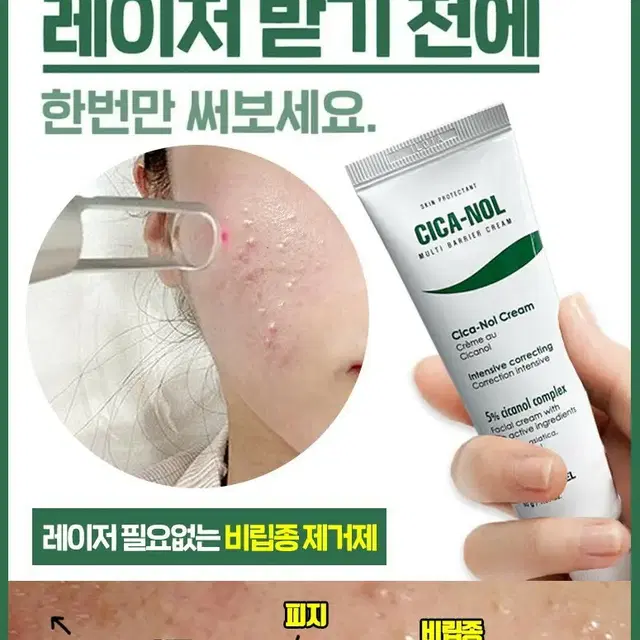 메디필시카놀크림2개