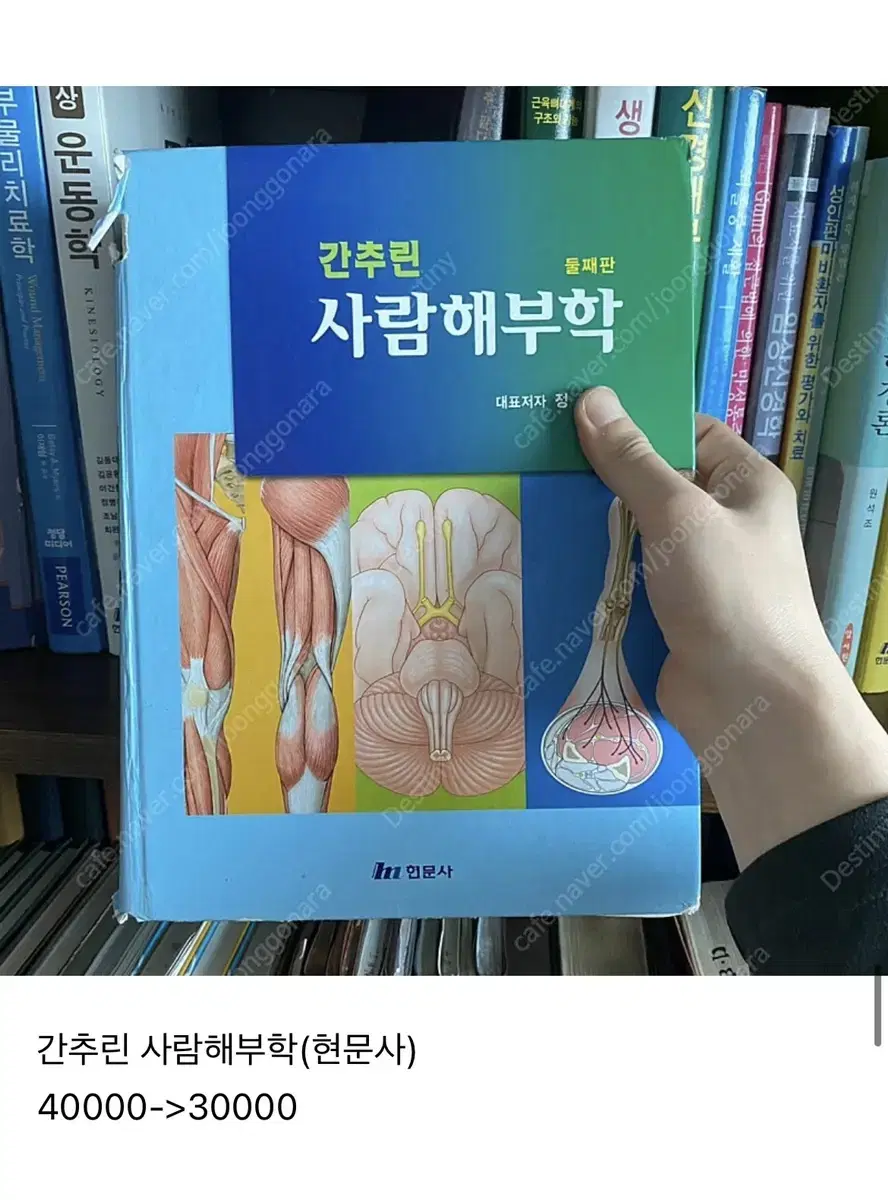 물리치료전공서적) 간추린 사람해부학(현문사)