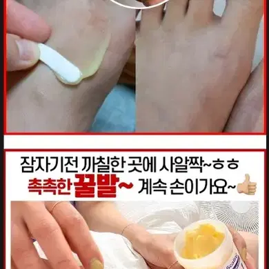 메디필 EGF 스케이링 모이스처 풋크림 티눈크림 굳은살 각질 티눈 화장품