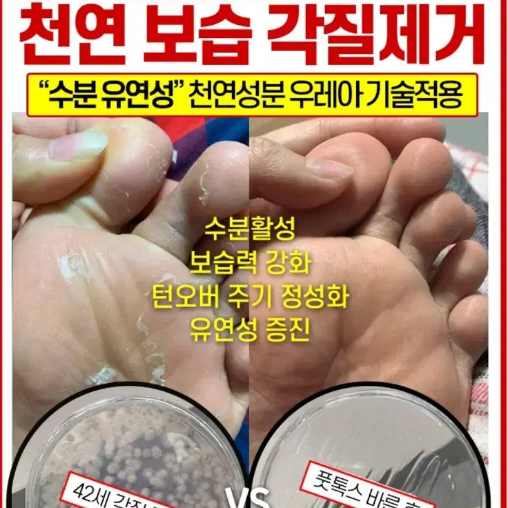 메디필 EGF 스케이링 모이스처 풋크림 티눈크림 굳은살 각질 티눈 화장품