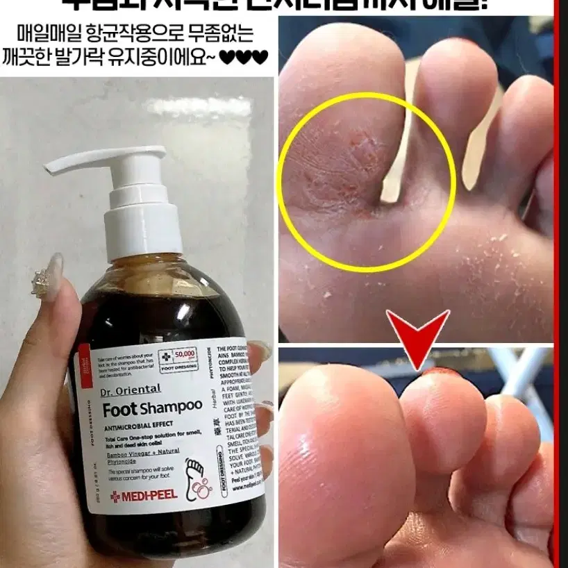 아기발 발냄새 발습진 각질 무좀 보습 한방 목초액 풋 샴푸 화장품 메디필