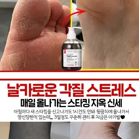 아기발 발냄새 발습진 각질 무좀 보습 한방 목초액 풋 샴푸 화장품 메디필