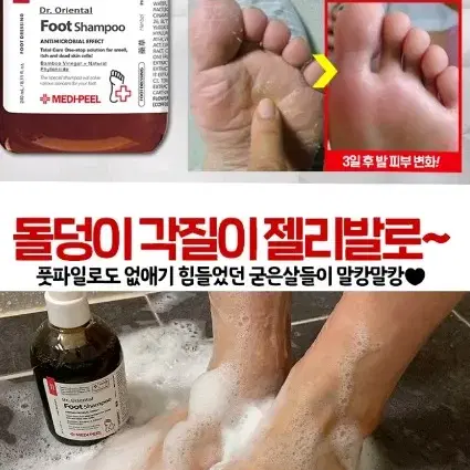 아기발 발냄새 발습진 각질 무좀 보습 한방 목초액 풋 샴푸 화장품 메디필