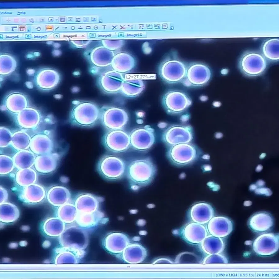 3안위상차현미경  생혈액  적혈구 백혈구
