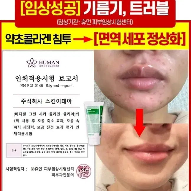 메디필 시카 폼 클렌징/모공속 진정케어 각질 예민한피부 모공 화장품