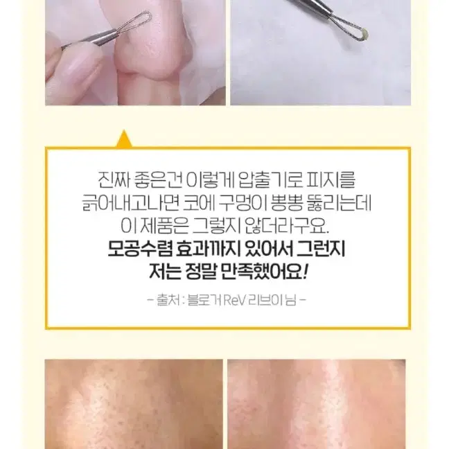 메디필 피지연화제+피지제거제 피지녹이는 블랙헤드 모공관리 화장품