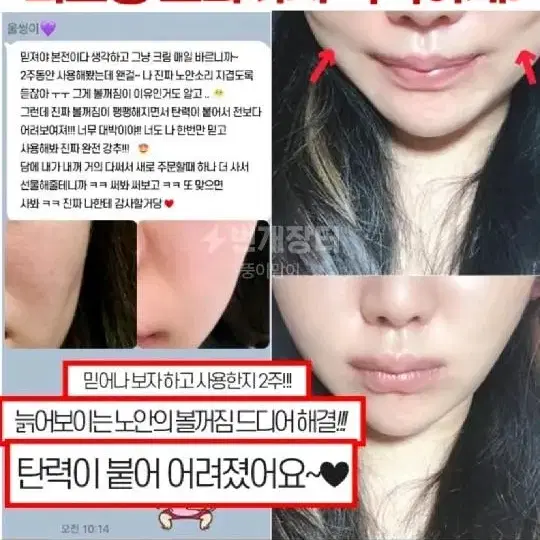 리뉴얼)볼복구크림,이마, 볼,눈밑,주름화장품 필러 에센스 앰플 메디필