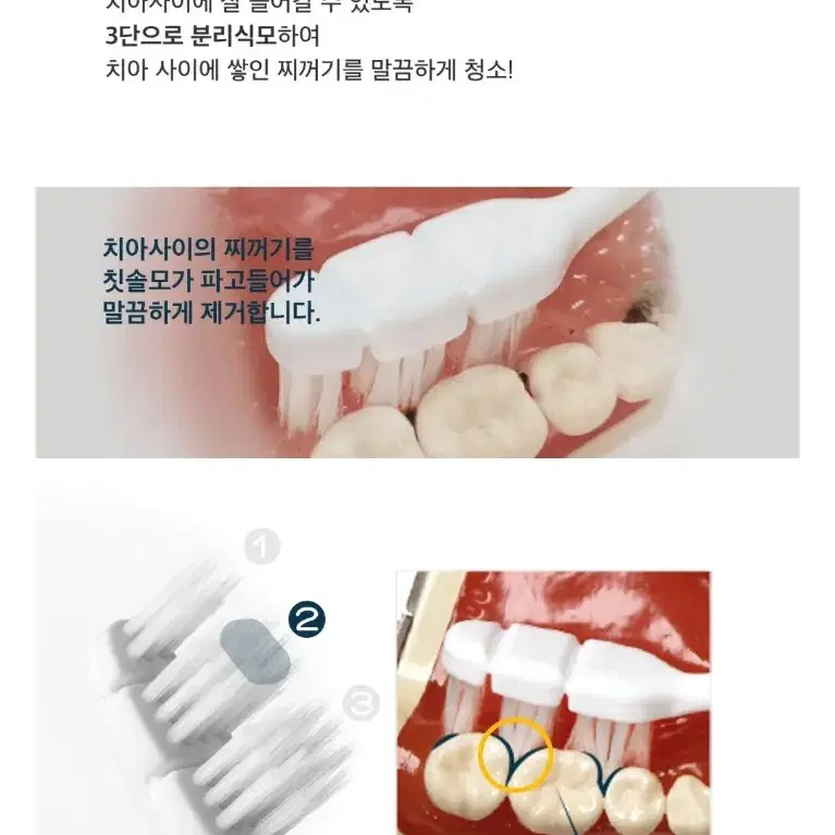 덴클 올인원케어 칫솔 새상품!!