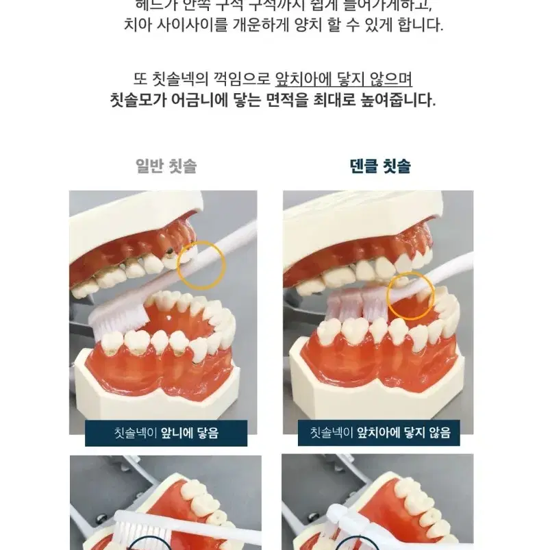 덴클 올인원케어 칫솔 새상품!!