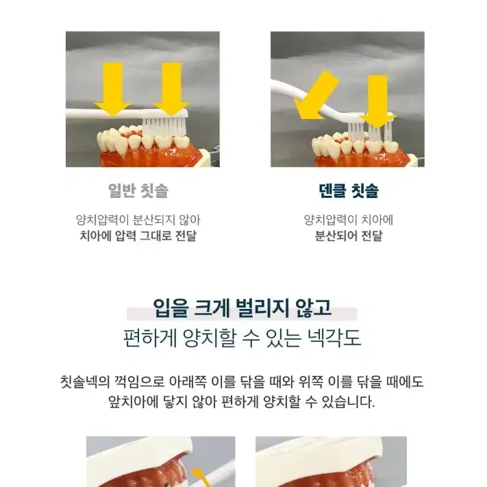 덴클 올인원케어 칫솔 새상품!!