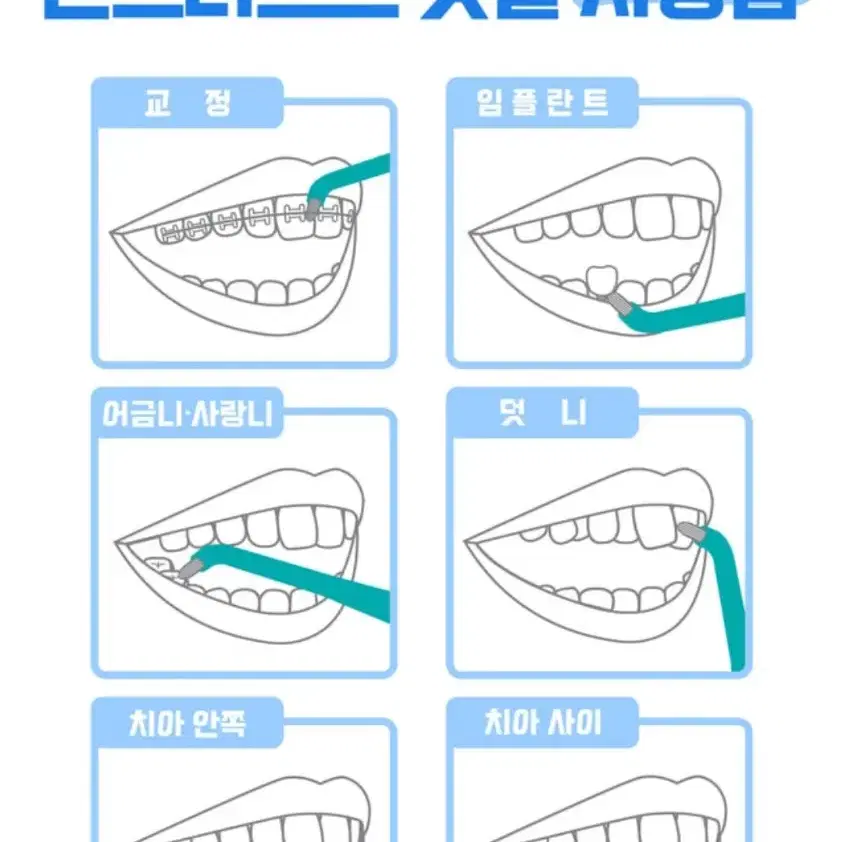 치과 전문 칫솔/ 위덴 칫솔