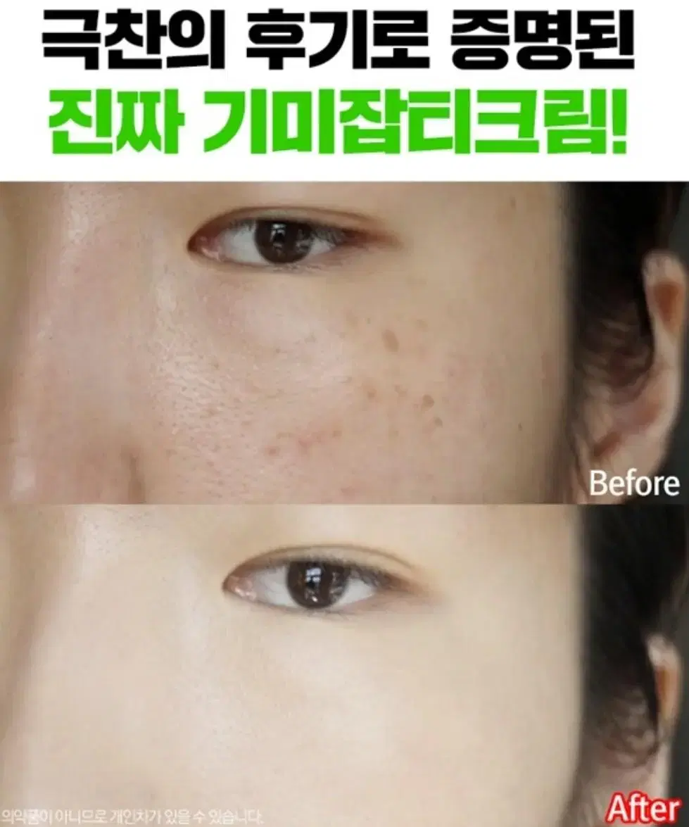 기미잡티크림 맥스클리닉 후기 3