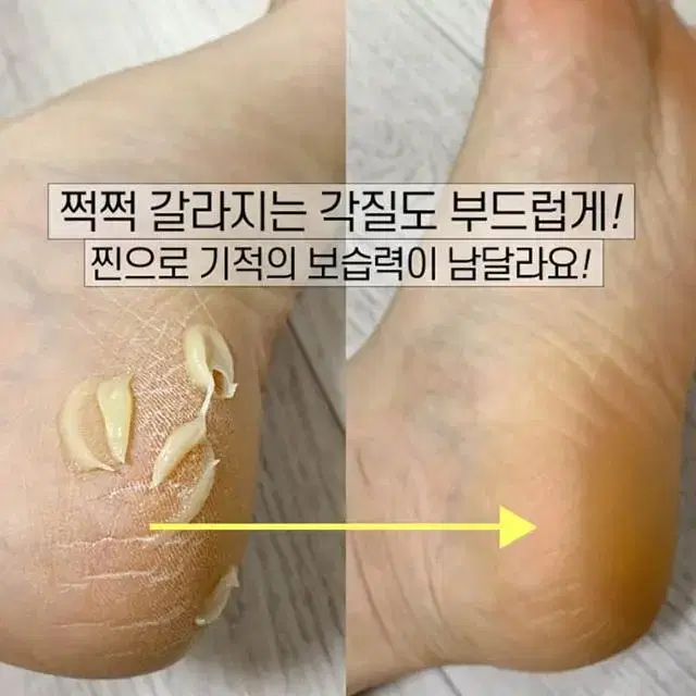 메디필 EGF 풋크림 각질 티눈 굳은살 제거 (면도기+솜털제모기 사은품)