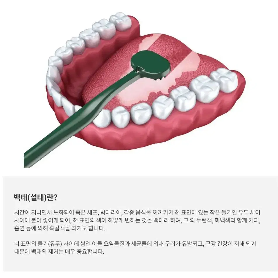 알오브이 혀클리너 블랙 / 4열 블래이드 미세모 프리미엄 구강관리