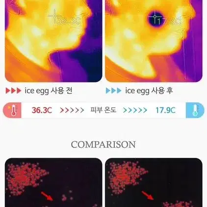 아이스에그 홈케어 크라이오셀 쿨러 갈바닉