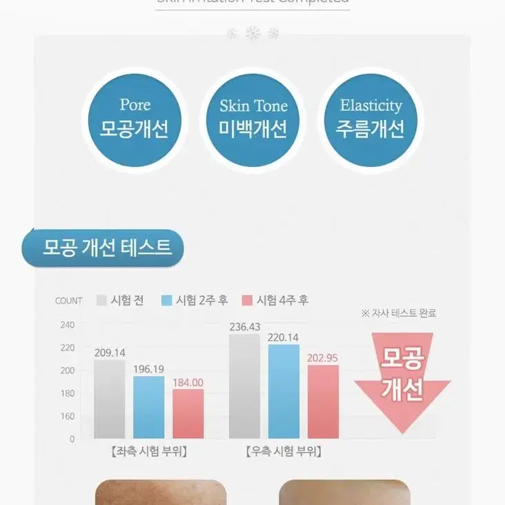 아이스에그 홈케어 크라이오셀 쿨러 갈바닉