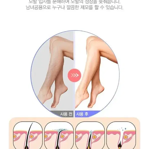 [무료배송]남녀공용 상처없는 팔 다리 피부 면도 털 사용이편한 제모기