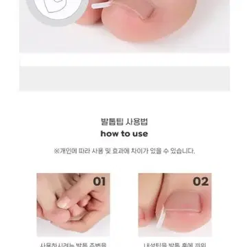 새상품+무배] 첫사랑발톱밴드 내성발톱관리 아픔방지 와이어팁 10P 편리 | 브랜드 중고거래 플랫폼, 번개장터