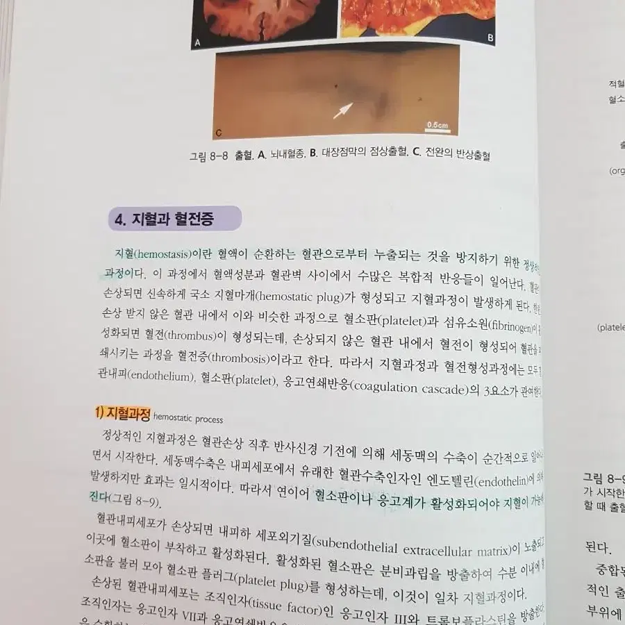 최신 알기쉬운 병리학 2판 수정판 현문사