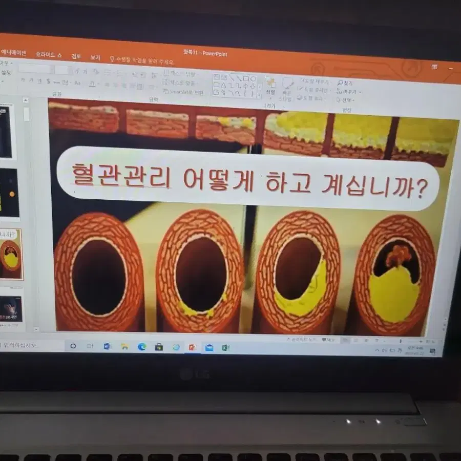 고주파ㅡ비고르바른건강