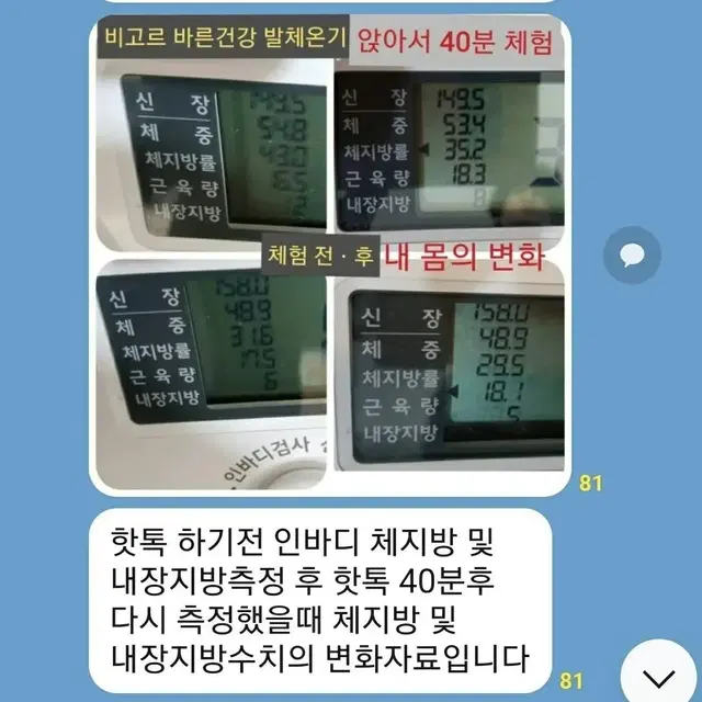 고주파 비고르바른건강