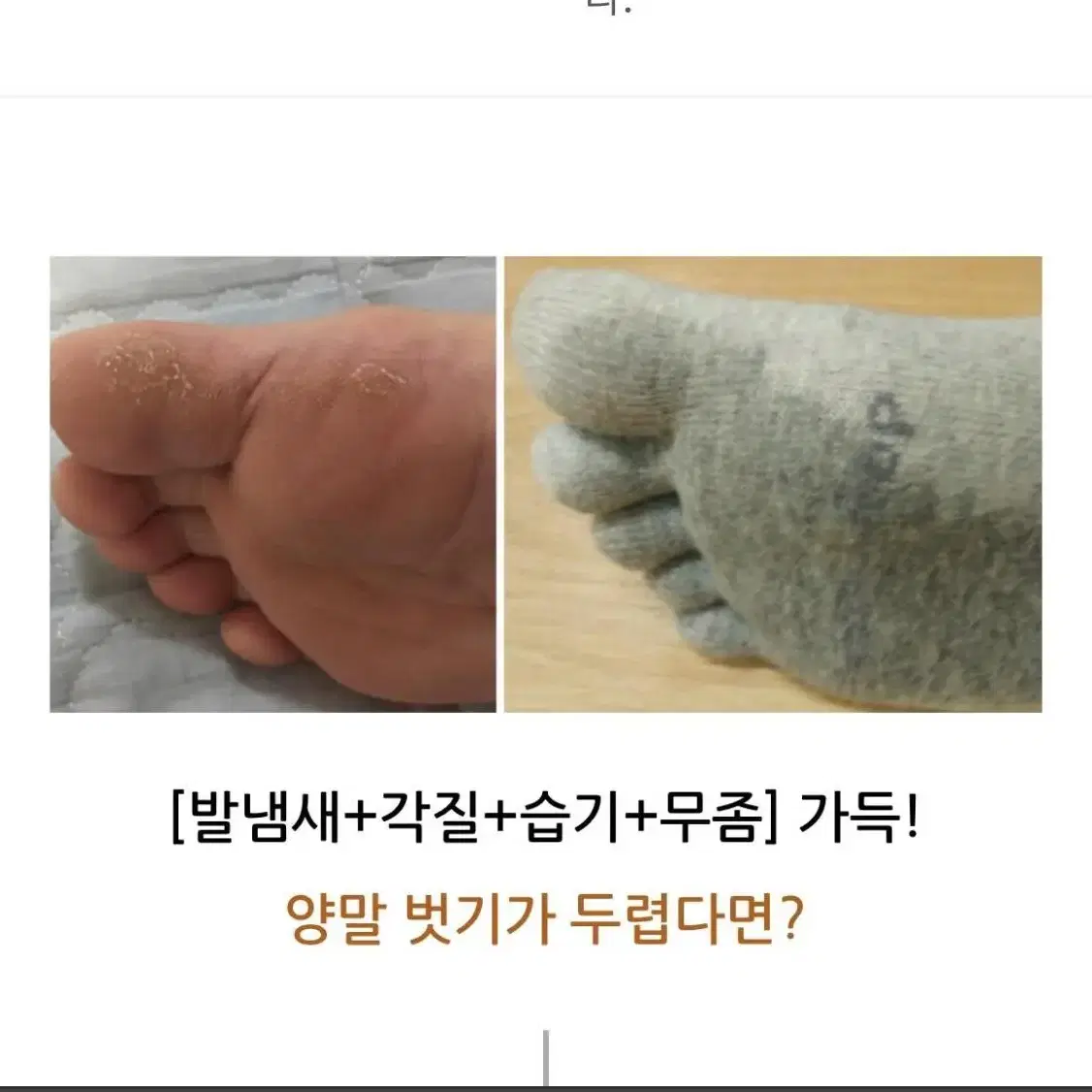 무좀비누 발비누 습진 발냄새 가려움 무좀균 강력제거