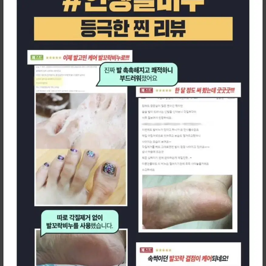 무좀비누 발비누 습진 발냄새 가려움 무좀균 강력제거