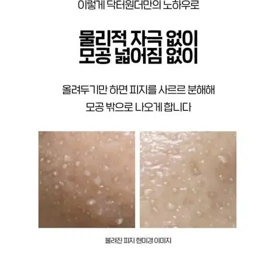 닥터원더 석션워터(피지연화제)(블랙헤드녹이기)