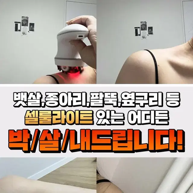 에르고바디 틈셀스타터 본체 + 3종 롤러헤드