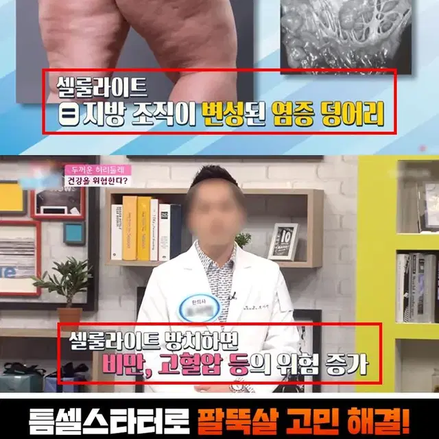 에르고바디 틈셀스타터 본체 + 3종 롤러헤드