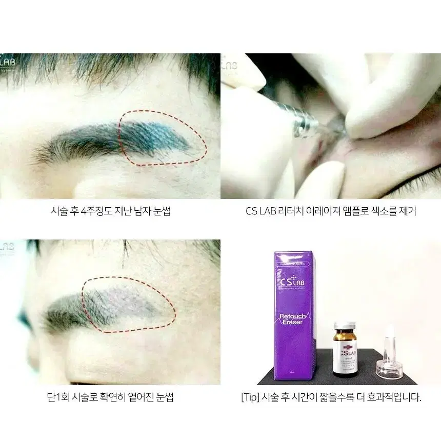 CS LAB 리터치 이레이져 8ml 반영구화장색소수정액 색소마커펜제거용액