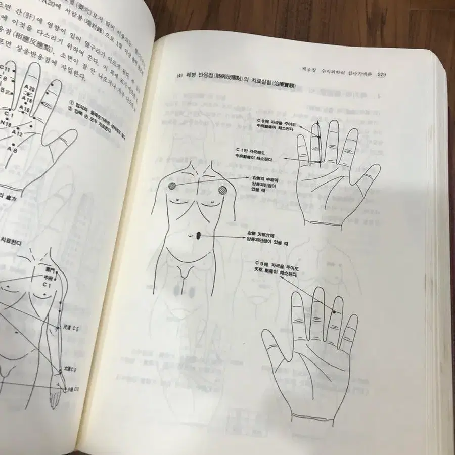 고려 수지침 교본