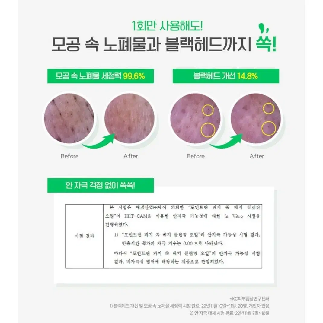 포인트앤 피지쏙 클렌징오일 230ml