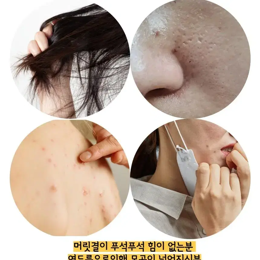 피부톤 up어성초 비누 100g