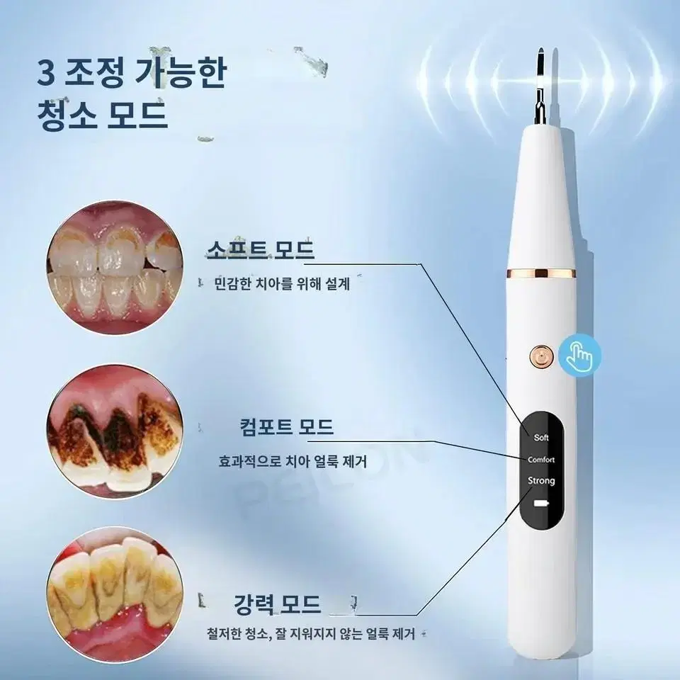 치아 관리 치석 제거 하얀 이빨 관리