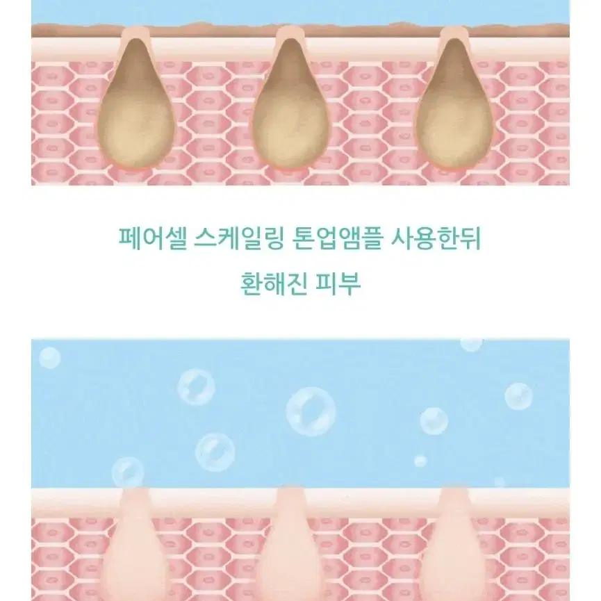 모공 도둑 깐달걀 블랙헤드 화이트헤드 모낭염 여드름 흉터 미백 톤업 앰플