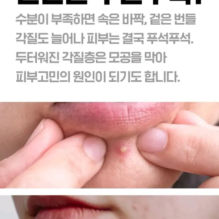 아이소이 아크닉닥터 컨트롤토닉