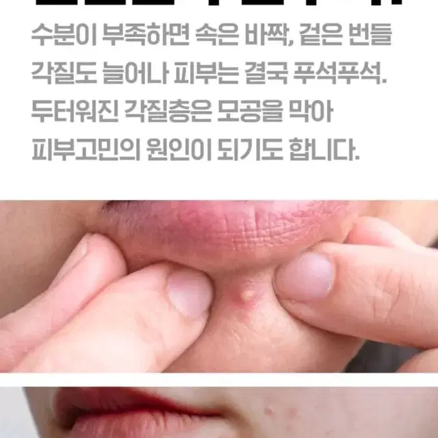 아크닉닥터 응급토너