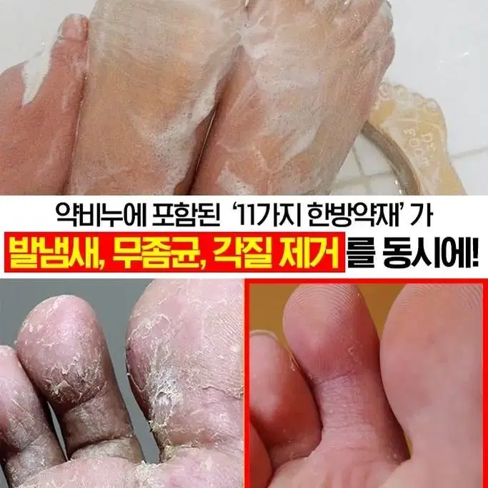 닥터풋 허브발 비누