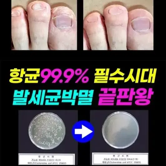 닥터풋 허브발 비누