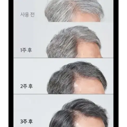 트리트룸 더모어 새치커버 블랙 트리트먼트 310ml(미개봉)