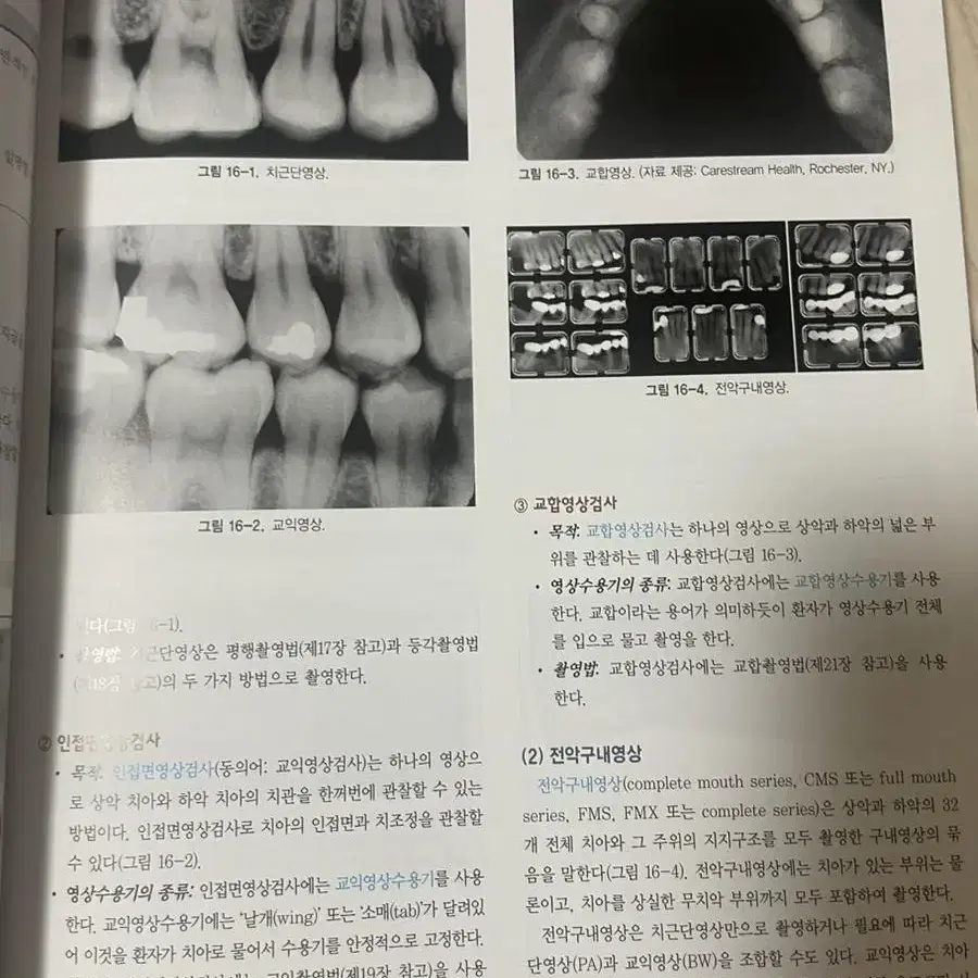 구강방사선학