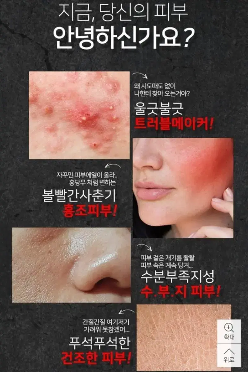 모낭염 트러블, 좁쌀,홍조,여드름 때문에 고민이라면 쿨잠 진정 수딩 크림