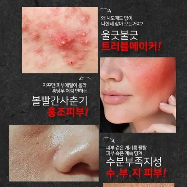 모낭염 트러블, 좁쌀,홍조,여드름 때문에 고민이라면 쿨잠 진정 수딩 크림