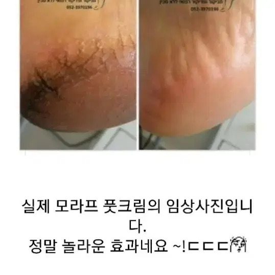 모라츠풋크림 겨울필수품