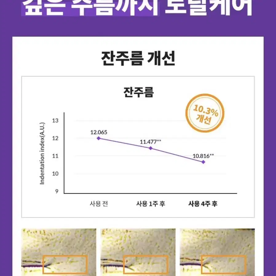 [새상품] 바이오힐보 콜라겐 스틱