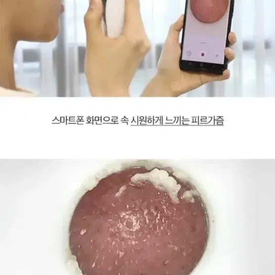 피지흡입 피지제거 뷰티인어스